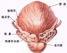 前列腺肥大的症状图片